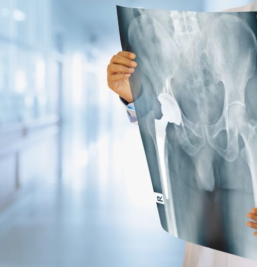 Bone Doctor in Borivali